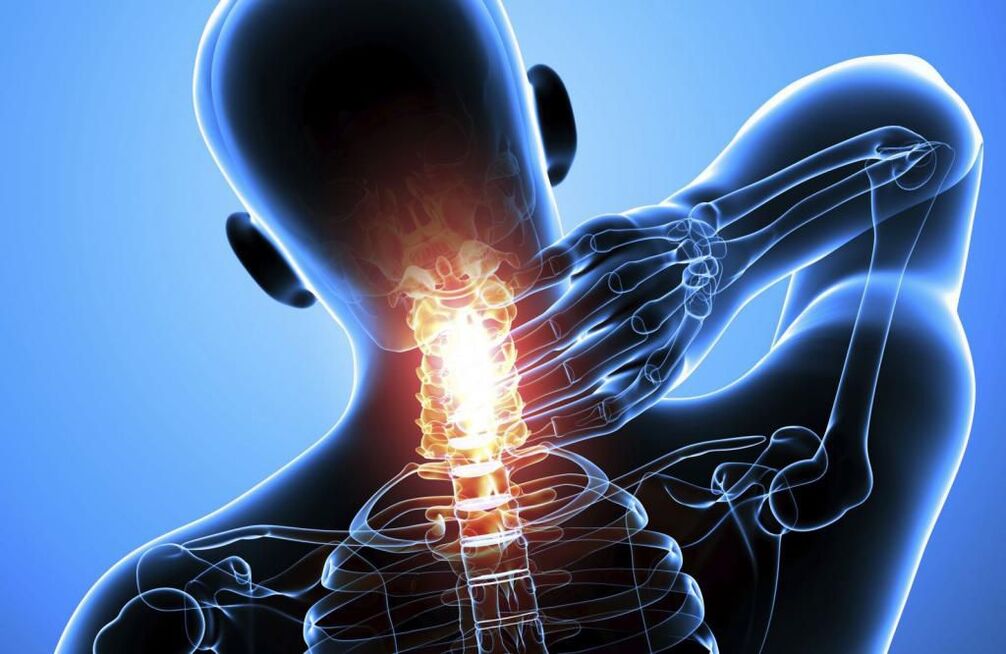 Osteochondrosis of the cervical spine