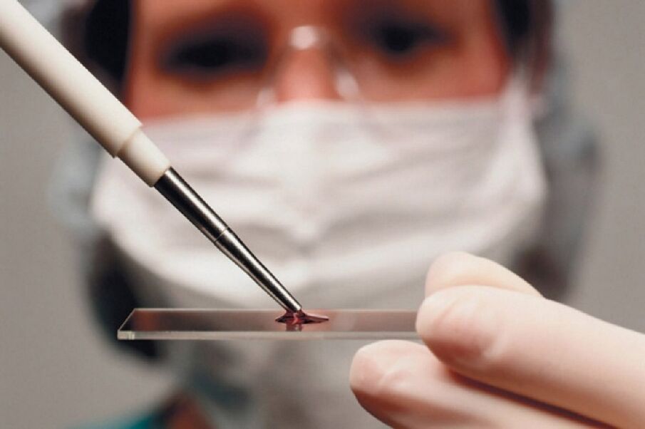 Arthritis is an inflammatory disease and its presence is detected through blood tests.