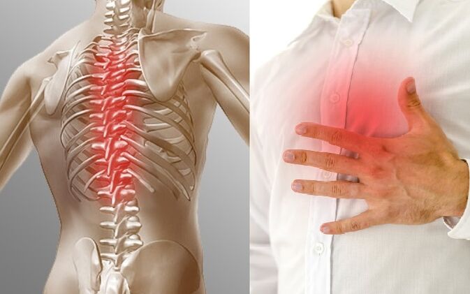 Thoracic osteochondrosis is manifested by pain and a feeling of tightness in the chest